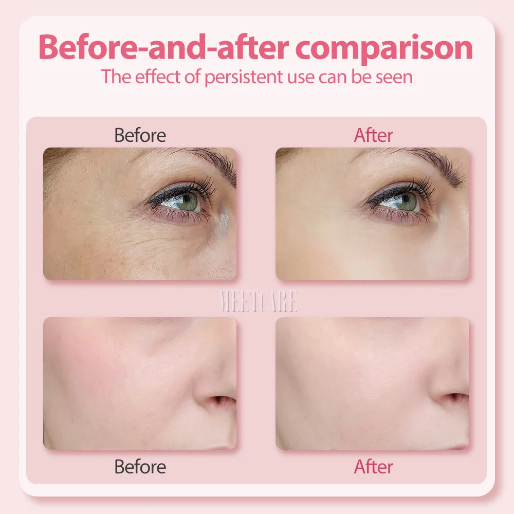 ES LIFESTYLE 4in1 Eye Facial Massage Wand EMS Hot Compress Red Light Neck Face Vibration Lift Skin Rejuvenation Sculpting Firm Tighten Tool