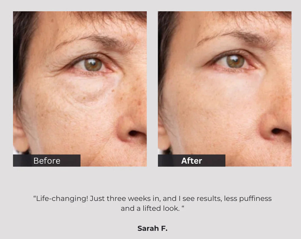 Radiance Repair Red Light Mask